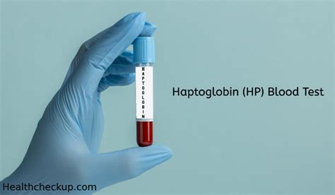 hqbto|Haptoglobin Test: Purpose, Procedure, and Results .